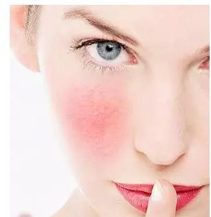 拿什么拯救你，紅血絲小姐