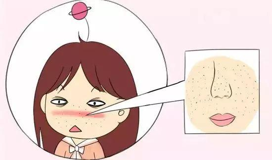 女生毛孔粗大到底應(yīng)該怎么辦？