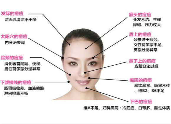 原來這些因素會(huì)導(dǎo)致長(zhǎng)痘痘！你知道嗎?